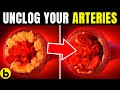 6 POWERFUL Heart Attack Preventing Foods That Can Help UNCLOG Arteries