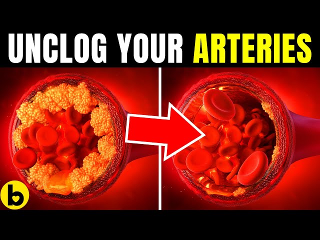 6 POWERFUL Heart Attack Preventing Foods That Can Help UNCLOG Arteries class=