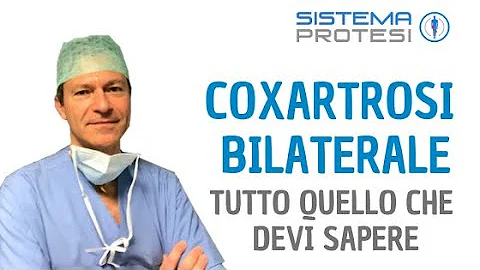 Quali sono i sintomi della coxartrosi bilaterale?