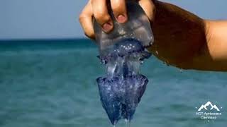 Медузы в Азовском море жалят и все тело печет ! Урзуф 2021 медузы монстры , после купания сыпь !