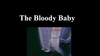 2. The Bloody Baby