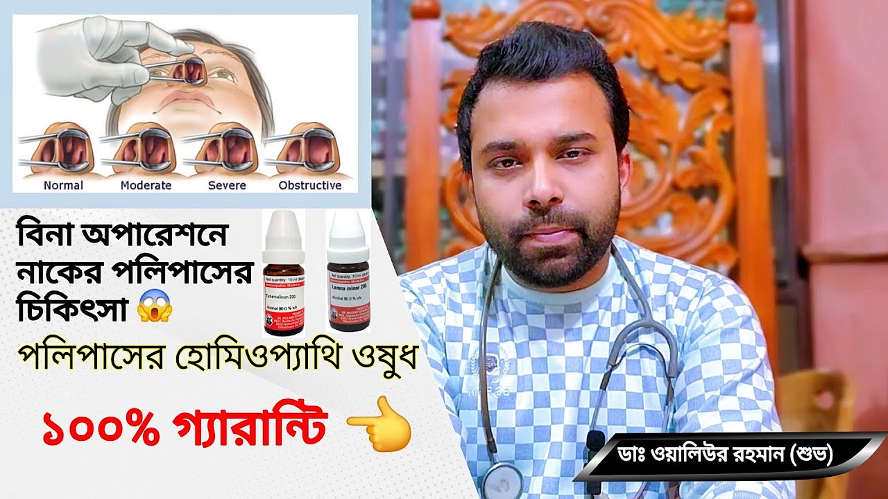 বিনা অপারেশনে নাকের পলিপাসের চিকিৎসা | নাকের মাংস বৃদ্ধির হোমিওপ্যাথি ওষুধ | Dr. Waliur Rahman Shuvo