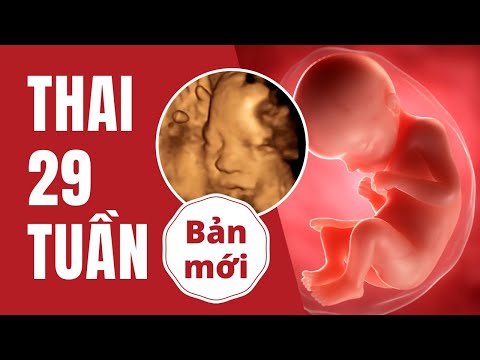 Video: Mang thai 29 tuần - Điều gì sẽ xảy ra