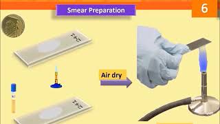 Preparation of Bacterial Smears-Lab 6