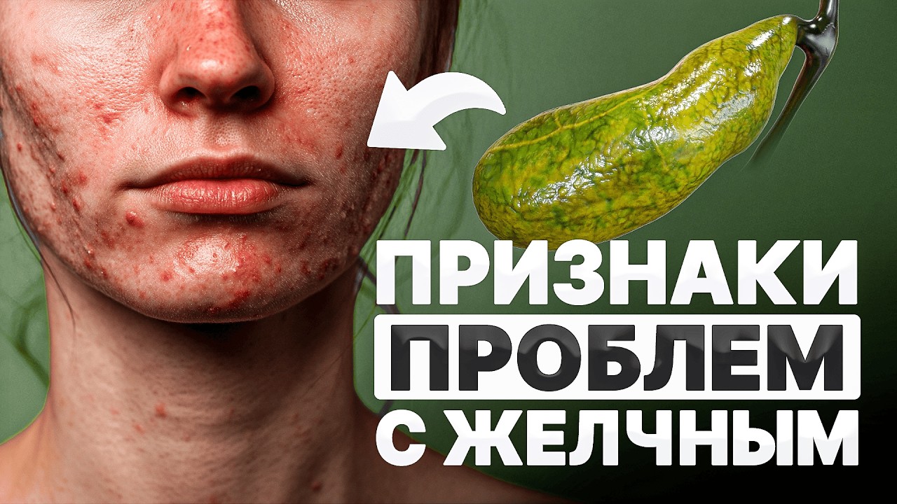 Желчный пузырь: как он влияет на твое самочувствие?