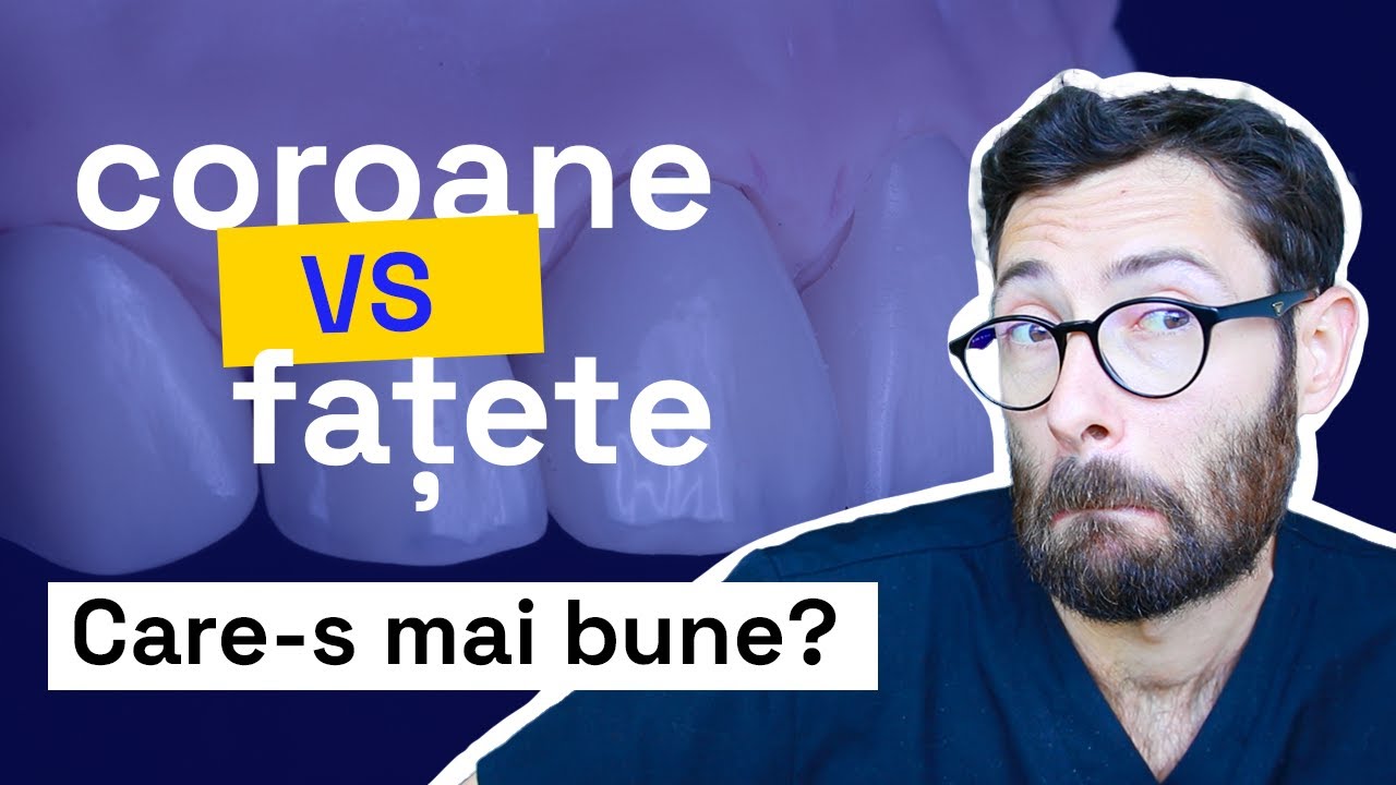 COROANE SAU FATETE? Ce e mai bine?