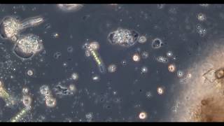 water under microscope - amoeba time lapse