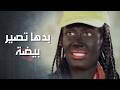 اتنكرت على انها بنت لونها اسود وراحت عند دكتورة التجميل لتغيرلها لونها وانصدمت بطلبها كذب ابيض اتنكرت على انها بنت لونها اسود وراحت عند دكتورة التجميل لتغيرلها لونها وانصدمت بطلبها كذب ابيض