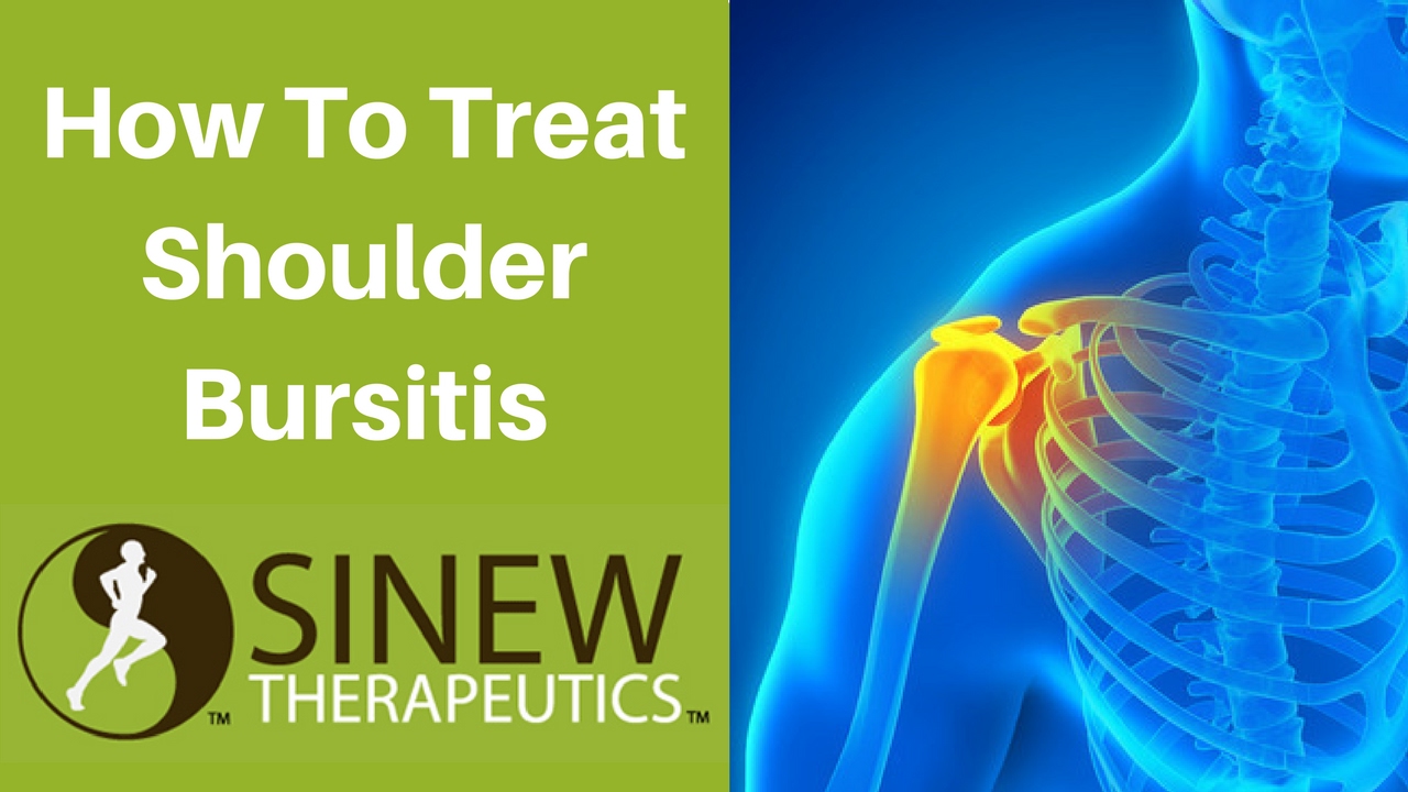 How To Treat Shoulder Bursitis and Speed Recovery YouTube
