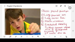 Fragile X syndrome (FXS)