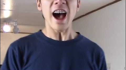 YOU CAN NOT ESCAPE WINDOWS 10  130x speed up