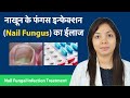 नाखून के फंगस इन्फेक्शन का ईलाज (हिंदी) | Nail Fungal infection symptoms, treatment and Medicines