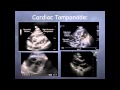 Tutorial: Basic echocardiography