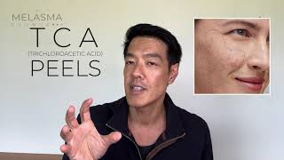 Are TCA peels good for Pigmentation? | Dr Davin Lim