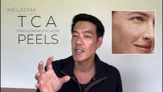 Are TCA peels good for Pigmentation? | Dr Davin Lim