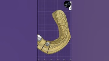 exocad Virtual Articulator