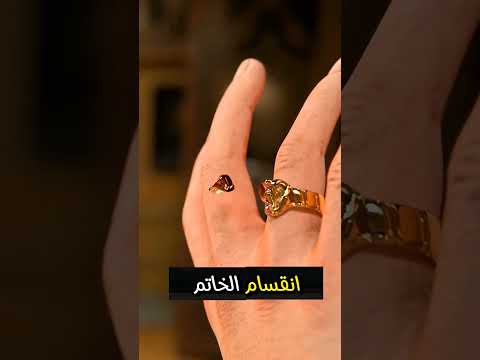 رصاصة قاتلة اصطدمت بخاتم الزواج و هده كانت النتيجة