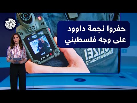 عناصر من شرطة الاحتلال يقومون بحفر نجمة داوود على وجه شاب مقدسي
