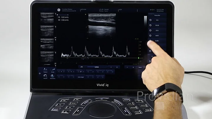 GE Vivid iq Training Part 3: Measurements and Annotations