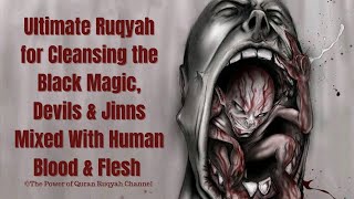 Ultimate Ruqyah for Cleansing the Black Magic,Jinns & Devils mixed in Human Flesh&Blood+919062777292