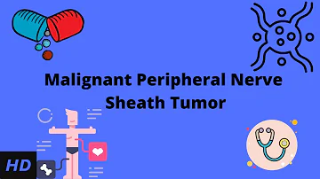 Malignant Peripheral Nerve Sheath Tumor, Causes, Signs and Symptoms, Diagnosis and Treatment.
