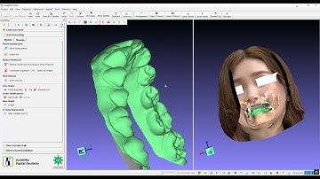 GuideMia Ortho+ training   full workflow with CBCT data and Facial Scan