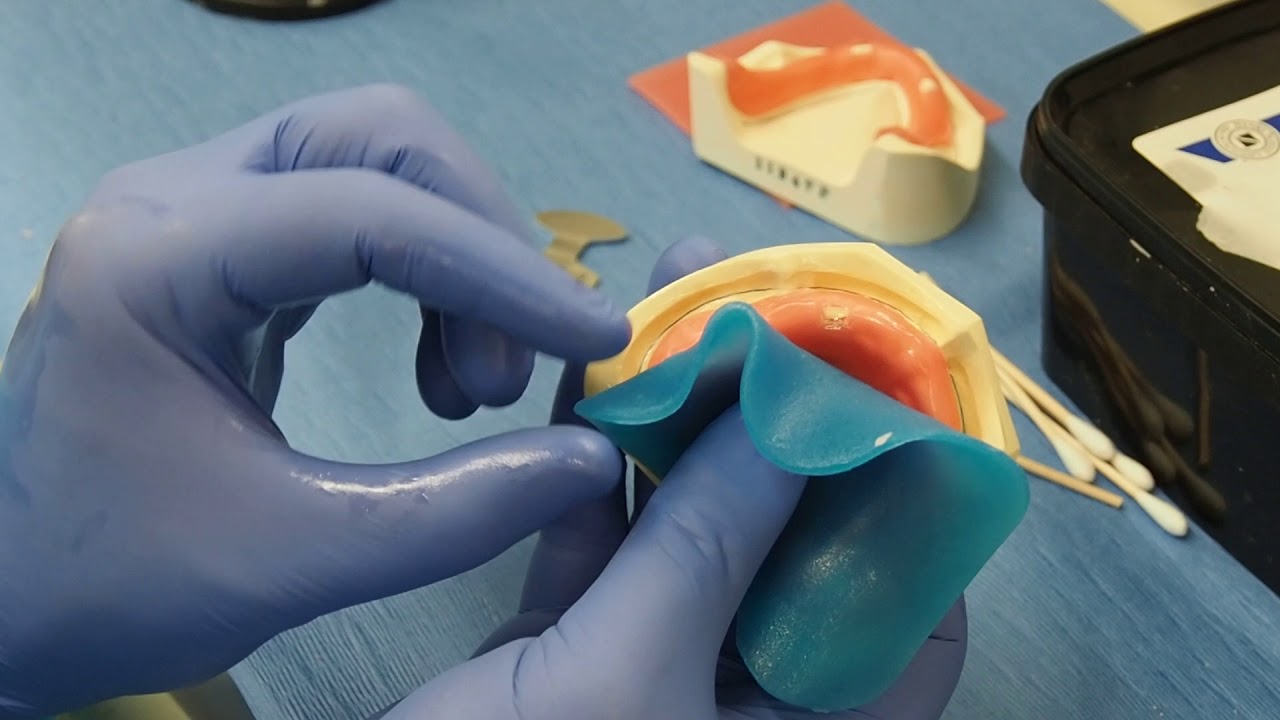 Impression trays 4 VLC layout upper