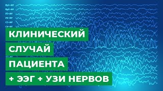 Клинический случай пациента + ЭЭГ + УЗИ нервов