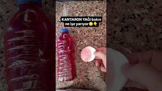 Bütün Yara Ve Yanıklarda Gönül Rahatlığıyla Kullanabilirsiniz