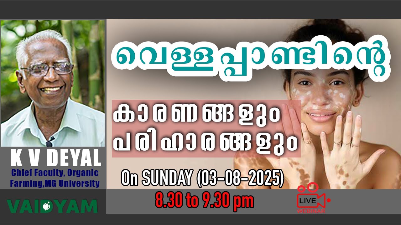 വെള്ളപ്പാണ്ടിന്റെ കാരണങ്ങളും പരിഹാരങ്ങളും #kvdayal #malayalam #live