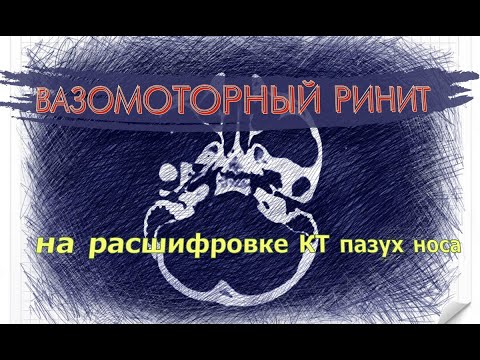 Video: Сөөк көпүрөсүнүн төөнөгүчтөрү татыктуубу?