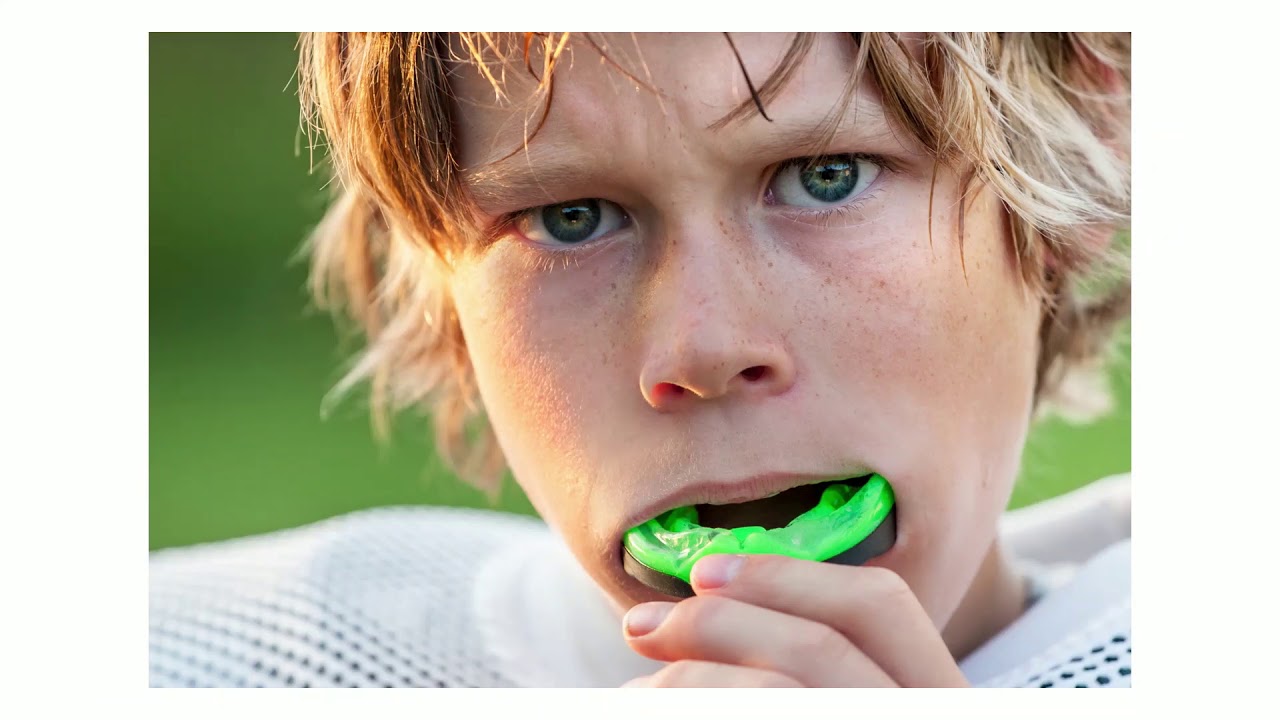 Why Sports Mouthguards are so Important YouTube