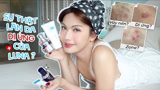 Top Skincare Cứu Cánh Làn Da Dị Ứng 💦 Luna Đào Giveaway Set Quà Beauty Siêu Xịn Mịn 🎁