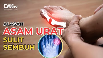 Alasan Asam Urat Sulit Sembuh | Bincang Sehati DAAI TV