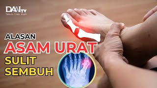 Alasan Asam Urat Sulit Sembuh  Bincang Sehati Daai Tv