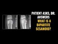 Bipartite Sesamoid Fractures - What You NEED To Know