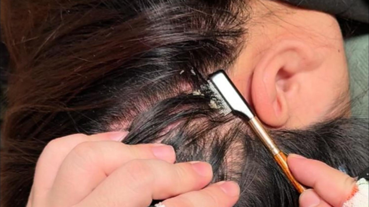 Jojo ASMR | Fine Comb & Tweezers Audio for Quiet Relaxation (No Talking)