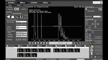 Performing Contact Biometry with the Ellex Eye Cubed