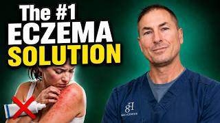 Eczema Is Not a Skin Problem. (Here’s What It is AND How to Fix It)