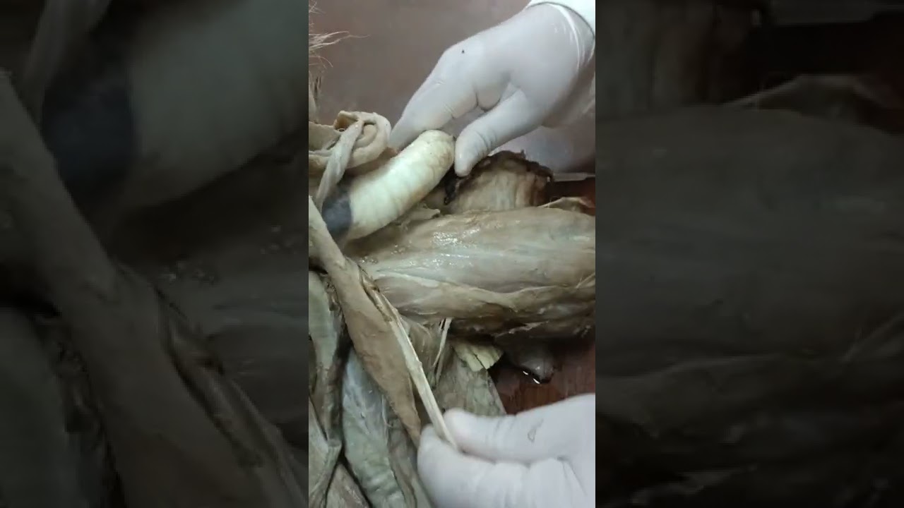 Muscles of the ventral surface of the neck دكتور رمضان ساري