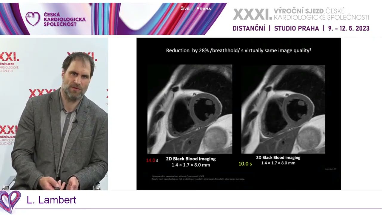 video: Symposium Philips esk republika s.r.o.