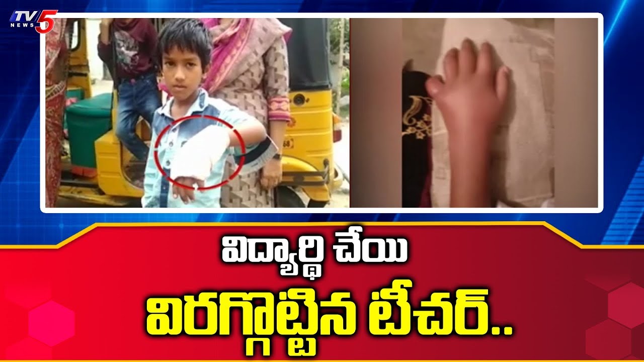 tv5 youtube telugu విద్యార్థి చేయి విరగ్గొట్టిన టీచర్..! | Hyderabad | TV5 News