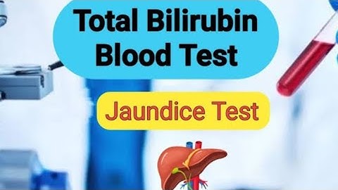 Total & Direct Bilirubin test procedure practical video | पीलिया टेस्ट |jaundice test