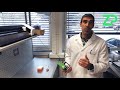 Measuring glucose/sugar on an Android phone - integrating biosensors with smart phones.