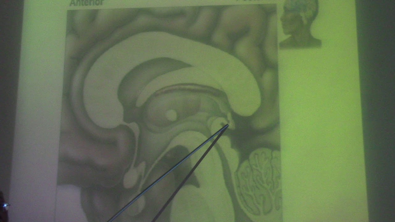 Neuroanatomy 93 ( Third ventricle, part 2 ) , by Dr. Wahdan - YouTube