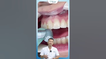 Tháo Mắc Cài Niềng Răng | Bác Sĩ Yên