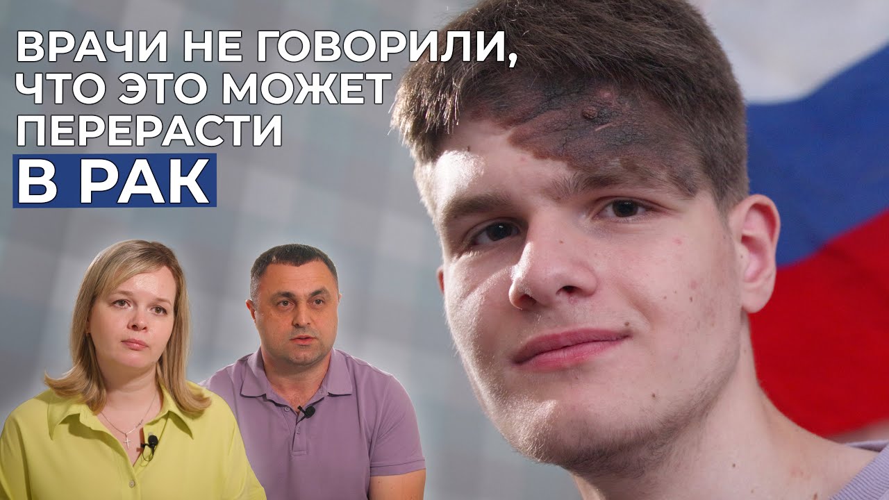 МЕЛАНОФОРМНЫЙ НЕВУС | История Глеба Столетова - YouTube