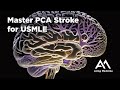 Pca stroke usmle