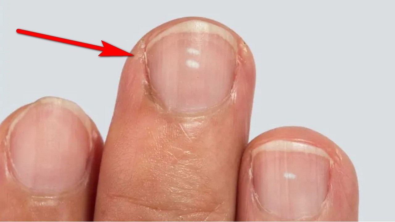 KALSİYUM DÜŞÜKSE NE OLUR ?