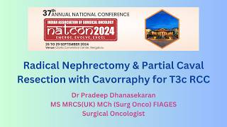 NATCON 2024 presentation | Radical Nephrectomy with IVC thrombectomy|  Dr Pradeep Dhanasekaran